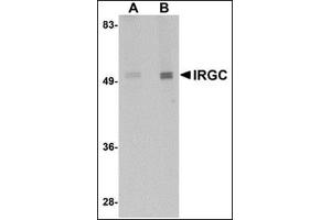 Western blot analysis of IRGC in mouse brain tissue lysate with this product at (A) 1 and (B) 2 μg/ml. (IRGC 抗体  (C-Term))