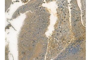 anti-Kalirin, RhoGEF Kinase (KALRN) (C-Term) antibody