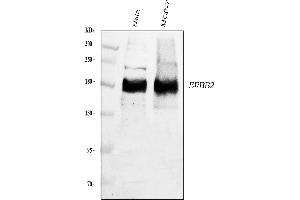 Western blot analysis of ErbB 2 using anti-ErbB 2 antibody (ABIN5518830). (ErbB2/Her2 抗体  (N-Term))