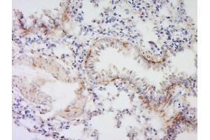 Formalin-fixed and paraffin embedded rat lung labeled with Anti- VSIG4 Polyclonal Antibody, Unconjugated  at 1:300 followed by conjugation to the secondary antibody and DAB staining. (VSIG4 抗体  (AA 81-160))