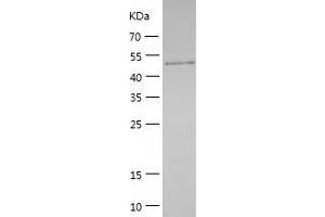 Western Blotting (WB) image for Protein Phosphatase 1F (PP2C Domain Containing) (PPM1F) (AA 1-454) protein (His tag) (ABIN7286283) (PPM1F Protein (AA 1-454) (His tag))