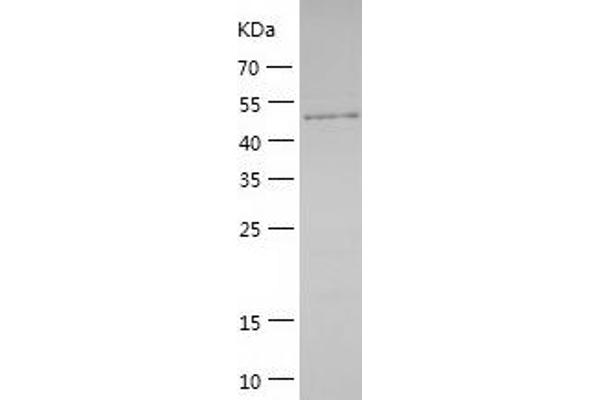 PPM1F Protein (AA 1-454) (His tag)