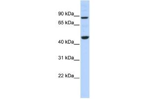 WB Suggested Anti-PPME1 Antibody Titration: 0. (PPME1 抗体  (N-Term))