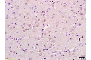 Formalin-fixed and paraffin embedded rat brain labeled with Rabbit Anti AP2 gamma Polyclonal Antibody, Unconjugated (ABIN720056) at 1:200 followed by conjugation to the secondary antibody and DAB staining (TFAP2C 抗体  (AA 2-100))