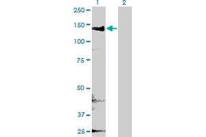 Western Blot analysis of CYFIP2 expression in transfected 293T cell line by CYFIP2 monoclonal antibody (M01), clone 4G6. (CYFIP2 抗体  (AA 733-820))