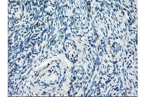 Immunohistochemical staining of paraffin-embedded colon tissue using anti-ZFP36 mouse monoclonal antibody. (ZFP36 抗体)
