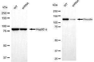 Western blotting analysis using Vinculin antibody (ABIN7800842). (Recombinant Vinculin 抗体)