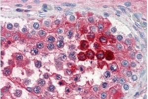 Immunohistochemistry (IHC) image for anti-Clusterin (CLU) (C-Term) antibody (ABIN185475)