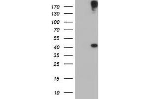 HEK293T cells were transfected with the pCMV6-ENTRY control (Left lane) or pCMV6-ENTRY AGPAT5 (Right lane) cDNA for 48 hrs and lysed. (AGPAT5 抗体)