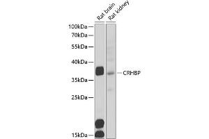 Western blot analysis of extracts of various cell lines, using CRHBP antibody (ABIN6129571, ABIN6139030, ABIN6139033 and ABIN6222243) at 1:1000 dilution. (CRHBP 抗体  (AA 25-322))