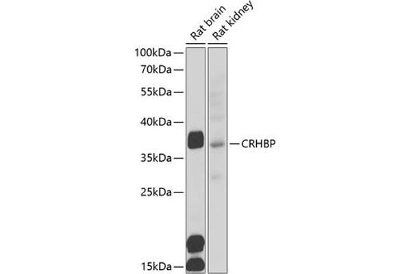 CRHBP Antikörper  (AA 25-322)