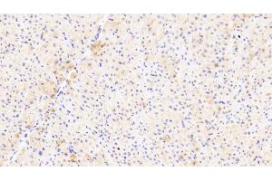 Detection of PARC in Human Cardiac Muscle Tissue using Polyclonal Antibody to Pulmonary Activation Regulated Chemokine (PARC) (CCL18 抗体  (AA 21-89))