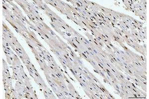 IHC analysis of Cyclophilin E/PPIE using anti-Cyclophilin E/PPIE antibody (ABIN7599242). (PPIE 抗体  (AA 1-301))