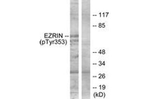 Western blot analysis of extracts from A431 cells treated with EGF 200ng/ml 30', using Ezrin (Phospho-Tyr353) Antibody. (Ezrin 抗体  (pTyr354))