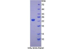SDS-PAGE analysis of Chicken Hemoglobin beta Protein. (Hemoglobin Subunit beta 蛋白)