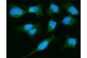 IF analysis of PARK7/DJ1 using anti-PARK7/DJ1 antibody (ABIN7600468). (PARK7/DJ1 抗体  (AA 2-189))