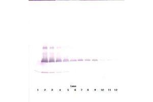 Image no. 3 for anti-Interleukin 17A (IL17A) antibody (ABIN465354) (Interleukin 17a 抗体)