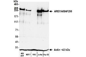 Western Blotting (WB) image for anti-AT Rich Interactive Domain 1A (SWI-Like) (ARID1A) (AA 750-800) antibody (ABIN7795678) (Recombinant ARID1A 抗体  (AA 750-800))