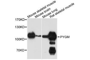 Western blot analysis of extracts of various cell lines, using PYGM antibody. (PYGM 抗体  (C-Term))