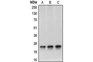 Western blot analysis of HP1 alpha expression in HeLa (A), NIH3T3 (B), C6 (C) whole cell lysates. (CBX5 抗体  (Center))
