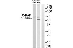 Western blot analysis of extracts from HuvEc cells and K562 cells treated with PMA using C-RAF (Phospho-Ser642) Antibody. (RAF1 抗体  (pSer642))