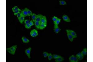 Immunofluorescence staining of HepG2 cells with ABIN7170083 at 1:166, counter-stained with DAPI. (KCC2 抗体  (AA 944-1071))