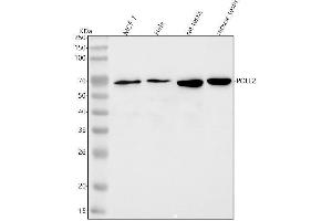 Western blot analysis of POLD3 using anti-POLD3 antibody (ABIN7599715).