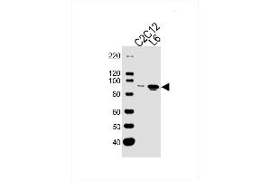 Lane 1: Mouse C2C12 Cell Lysates, Lane 2: Rat L6 Cell Lysates, probed with Musk (1429CT456. (MUSK 抗体)