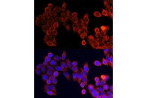 Immunofluorescence analysis of HeLa cells using MTOR antibody. (MTOR 抗体)