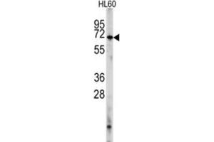 Western Blotting (WB) image for anti-phosphodiesterase 8A (PDE8A) antibody (ABIN2998130) (PDE8A 抗体)