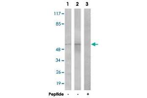 Western blot analysis of extracts from COLO cells (Lane 1) and HepG2 cells (Lane 2 and 3), using TGFBR1 polyclonal antibody . (TGFBR1 抗体  (Ser165))