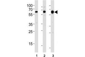 Western Blotting (WB) image for anti-Proto-oncogene tyrosine-protein kinase Src (Src) (AA 1-30) antibody (ABIN3029561)