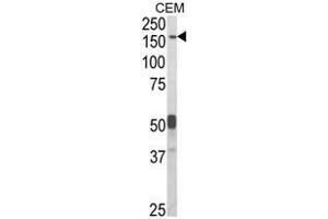 Western blot analysis of CNTNAP2 Antibody (Center) in CEM cell line lysates (35ug/lane). (CNTNAP2 抗体  (Middle Region))
