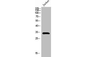 Western Blot analysis of Jurkat cells using Pitx1 Polyclonal Antibody (PITX1 抗体  (Internal Region))