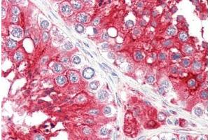 Human Testis (formalin-fixed, paraffin-embedded) stained with ACE2 antibody ABIN461888 at 2. (ACE2 抗体  (Internal Region))