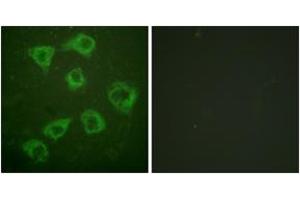 Immunofluorescence analysis of HuvEc cells, using KSR (Ab-392) Antibody. (KSR1 抗体  (AA 358-407))