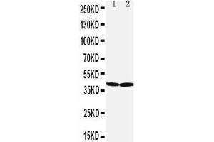 Western Blotting (WB) image for anti-Solute Carrier Family 10 (Sodium/bile Acid Cotransporter Family), Member 1 (SLC10A1) (AA 141-154), (Middle Region) antibody (ABIN3044254)