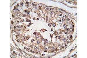 IHC analysis of FFPE human testis tissue stained with TBK antibody (TBK1 抗体  (AA 150-181))