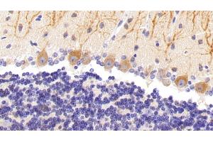 Immunohistochemistry (IHC) image for anti-Nitric Oxide Synthase 1, Neuronal (NOS1) (AA 53-247) antibody (ABIN7437716)