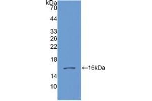 Western blot analysis of recombinant Human GDF6. (GDF6 抗体  (AA 336-455))
