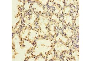 Immunohistochemistry of paraffin-embedded human lung tissue using ABIN7176105 at dilution of 1:100 (ZNF114 抗体  (AA 1-414))