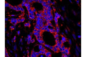 Immunofluorescence (IF) image for anti-Ubiquitin Specific Peptidase 3 (USP3) (AA 471-521) antibody (ABIN7449030) (USP3 抗体  (AA 471-521))