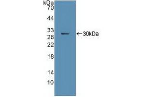 Western blot analysis of recombinant Human Ki67P. (Ki-67 抗体  (AA 3088-3235))