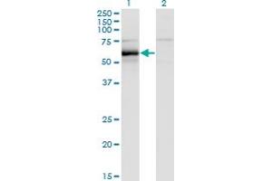 Western Blot analysis of HCK expression in transfected 293T cell line by HCK monoclonal antibody (M01), clone 1D9-1A9.