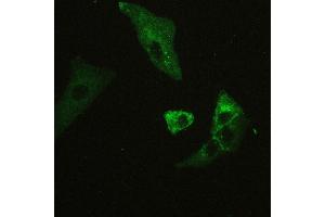 Immunohistochemistry (IHC) image for anti-Basigin (Ok Blood Group) (BSG) (AA 138-323) antibody (ABIN5518743)