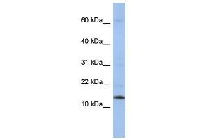 SNRPD2 antibody used at 1 ug/ml to detect target protein. (SNRPD2 抗体  (Middle Region))
