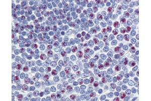 FOXM1 antibody was used for immunohistochemistry at a concentration of 4-8 ug/ml.