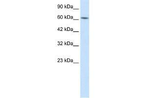 WB Suggested Anti-BTBD5 Antibody Titration:  1. (KLHL28 抗体  (Middle Region))