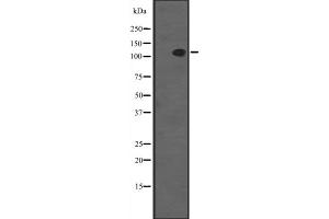 Western blot analysis of SYCP1 expression in MCF7 whole cell lysate ,The lane on the left is treated with the antigen-specific peptide. (SYCP1 抗体  (C-Term))