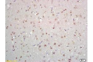Formalin-fixed and paraffin embedded rat brain labeled with Anti-ZNF423/OAZ Polyclonal Antibody, Unconjugated (ABIN1385826) at 1:200 followed by conjugation to the secondary antibody and DAB staining (Znf423 抗体  (AA 901-1000))